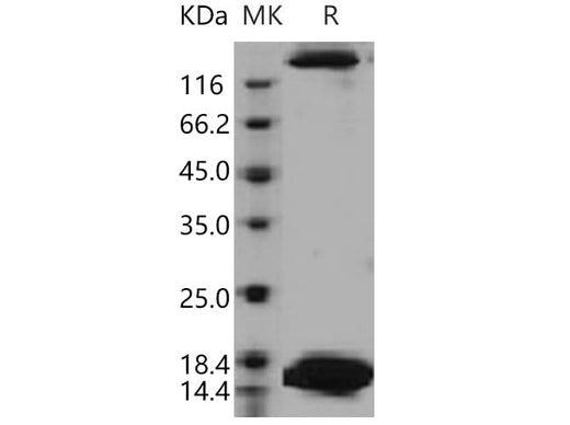 Recombinant Human SPEG/APEG-1 Protein (His Tag) - ABMIUM