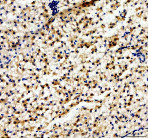Anti-Zebrafish ABCC12 Antibody Boster Bio