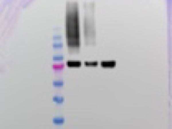 Anti-Fruit fly Me31B Antibody Boster Bio