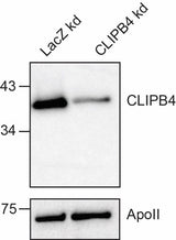 Anti-African malaria mosquito CLIPB4 Antibody Boster Bio