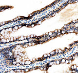 Anti-Zebrafish Tfap2a Antibody Boster Bio