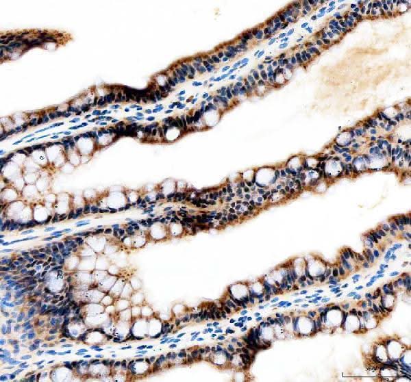 Anti-Zebrafish Tfap2a Antibody Boster Bio