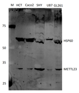 Anti-Human METTL23 Antibody Boster Bio