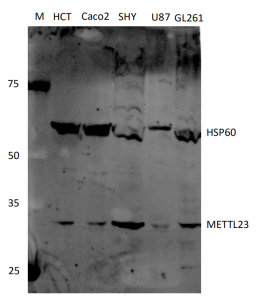 Anti-Human METTL23 Antibody Boster Bio