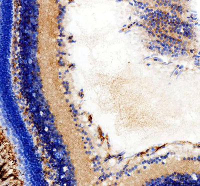 Anti-Zebrafish hsd17b14 Antibody Boster Bio