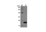 SDS-PAGE analysis of Mouse IL-1β proteins, 2 μg/lane of Recombinant Mouse IL-1β proteins was resolved with SDS-PAGE under reducing conditions, showing bands at 17 kDa.