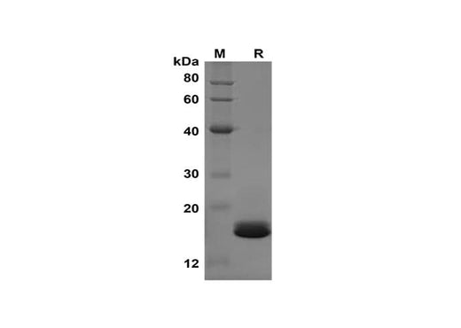 SDS-PAGE analysis of Mouse IL-1β proteins, 2 μg/lane of Recombinant Mouse IL-1β proteins was resolved with SDS-PAGE under reducing conditions, showing bands at 17 kDa.