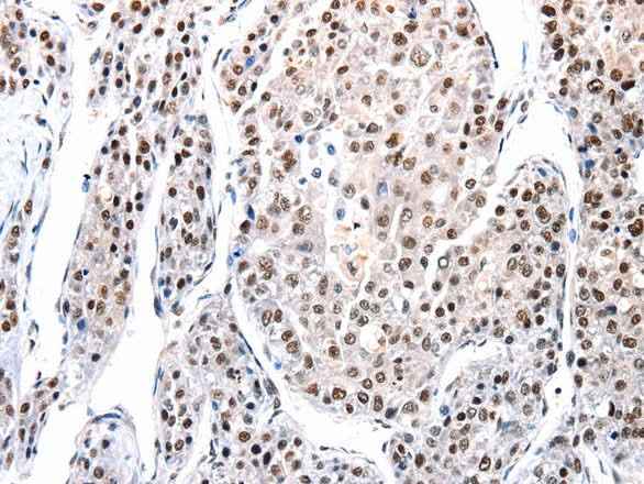 Anti-Human/Mouse/Rat AQP2 Antibody