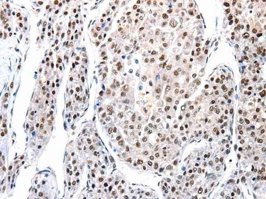 Anti-Human/Mouse/Rat AQP2 Antibody
