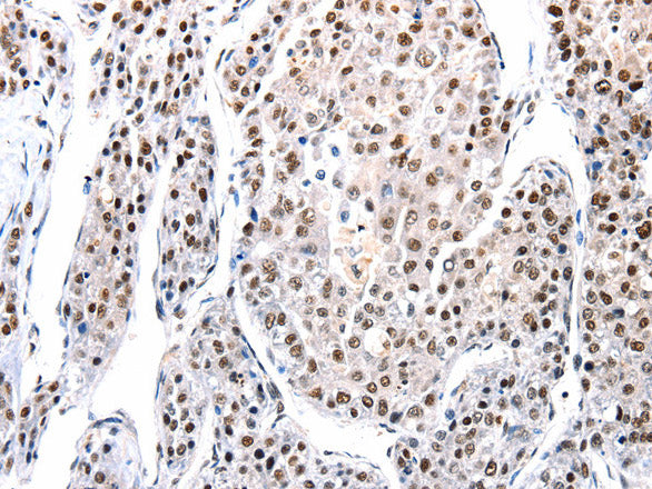 Anti-Human/Mouse/Rat AQP2 Antibody - ABMIUM