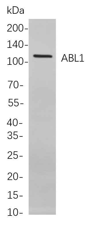 Anti-Human ABL1 Antibody [B790] - ABMIUM