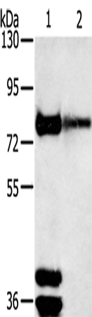 Anti-Human/Mouse/Rat TRIM3 Antibody - ABMIUM