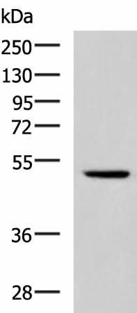 Western blot analysis of Hela cell lysate using IRF2 Polyclonal Antibody at dilution of 1:900