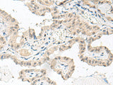 Anti-Human GFI1B Antibody - ABMIUM