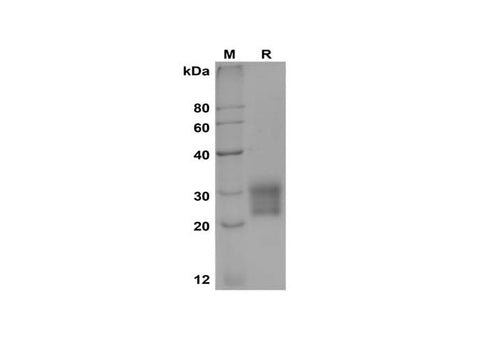 SDS-PAGE analysis of Rat IL-6 proteins, 2 μg/lane of Recombinant Rat IL-6 proteins was resolved with SDS-PAGE under reducing conditions, showing bands at 20-30 kDa.