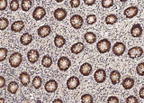 Anti-Human TXN2 Antibody [B351]