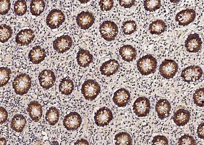 Anti-Human TXN2 Antibody [B351] - ABMIUM
