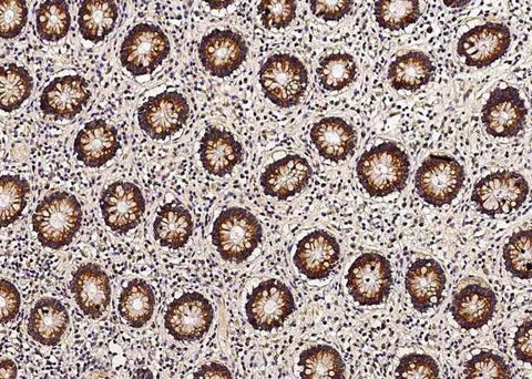 Anti-Human TXN2 Antibody [B351] - ABMIUM