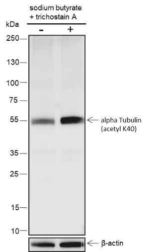 Anti-Human/Rat/Mouse alpha Tubulin (Acetyl K40) Antibody [A105] - ABMIUM
