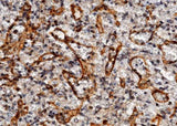 Anti-Human ICAM2 Antibody [A1025] - ABMIUM