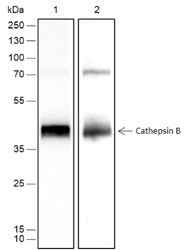 Anti-Human Cathepsin B Antibody [A464] - ABMIUM