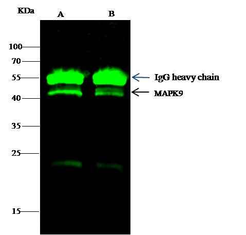 Anti-Human MAPK9 Antibody [B269] - ABMIUM