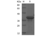 SDS-PAGE analysis of Mouse Tn-I proteins, 2 μg/lane of Recombinant Mouse Tn-I proteins was resolved with SDS-PAGE under reducing conditions, showing bands at 32 kDa.