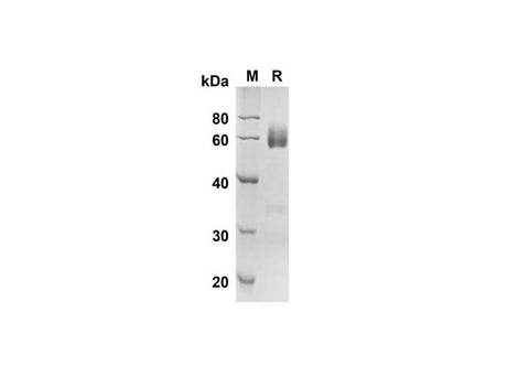 SDS-PAGE analysis of Mouse Angptl4 proteins, 2 μg/lane of Recombinant Mouse Angptl4 proteins was resolved with SDS-PAGE under reducing conditions, showing bands at 49.4 kDa.