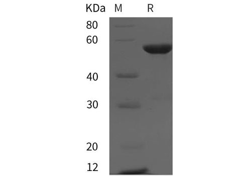SDS-PAGE analysis of Rat cyclin A2/CCNA2 proteins, 2 μg/lane of Recombinant Rat cyclin A2/CCNA2 proteins was resolved with SDS-PAGE under reducing conditions, showing bands at 50 kDa.