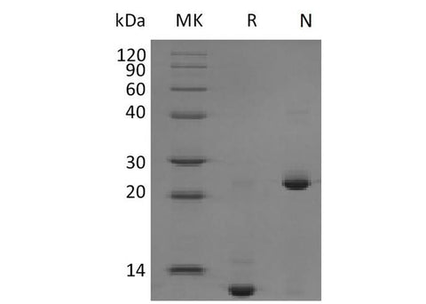Recombinant Mouse TGFB2 Protein - ABMIUM