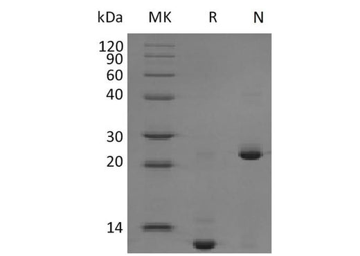 Recombinant Mouse TGFB2 Protein - ABMIUM