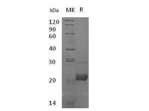 Recombinant Human Complement Component C8 Gamma Chain/C8G Protein (His Tag) - ABMIUM