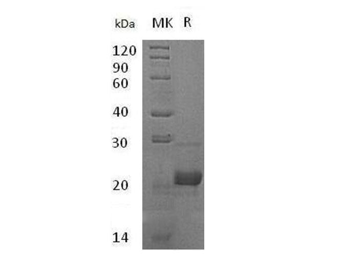 Recombinant Human Complement Component C8 Gamma Chain/C8G Protein (His Tag) - ABMIUM
