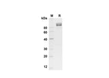 SDS-PAGE analysis of Mouse CD117/c-kit proteins , 2 μg/lane of Recombinant Mouse CD117/c-kit proteins was resolved with SDS-PAGE under reducing conditions , showing bands at 90 kDa.