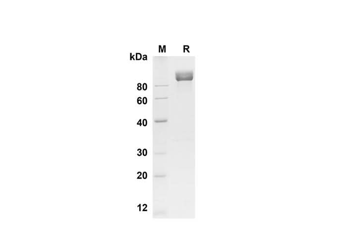 SDS-PAGE analysis of Mouse CD117/c-kit proteins , 2 μg/lane of Recombinant Mouse CD117/c-kit proteins was resolved with SDS-PAGE under reducing conditions , showing bands at 90 kDa.
