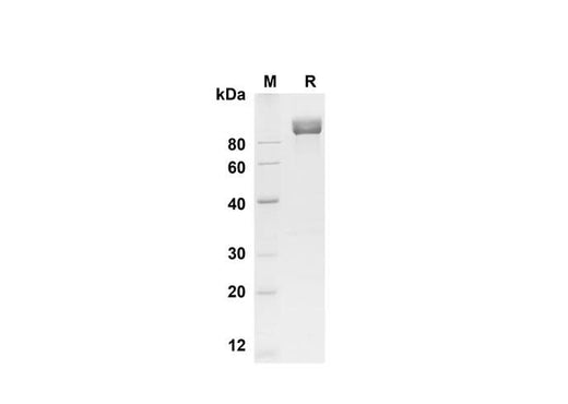 SDS-PAGE analysis of Mouse CD117/c-kit proteins , 2 μg/lane of Recombinant Mouse CD117/c-kit proteins was resolved with SDS-PAGE under reducing conditions , showing bands at 90 kDa.
