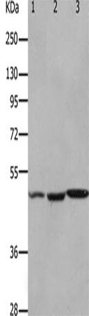 Anti-Human/Mouse/Rat HCRTR2 Antibody - ABMIUM