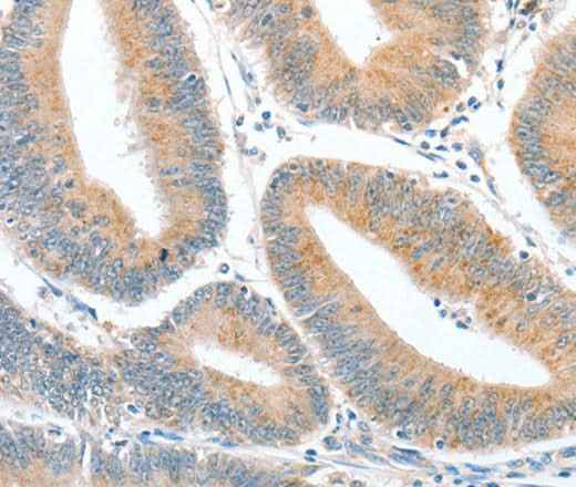 Anti-Human CKAP2 Antibody