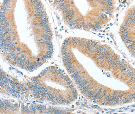 Anti-Human CKAP2 Antibody - ABMIUM
