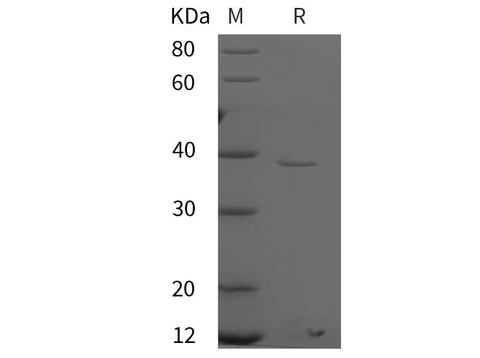 SDS-PAGE analysis of Human PARP11 proteins, 2 μg/lane of Recombinant Human PARP11 proteins was resolved with SDS-PAGE under reducing conditions, showing bands at 38 kDa.