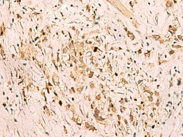 Anti-Human/Mouse/Rat SGTA Antibody