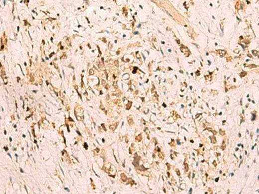 Anti-Human/Mouse/Rat SGTA Antibody
