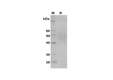SDS-PAGE analysis of Rat CD163 proteins, 2 μg/lane of Recombinant Rat CD163 proteins was resolved with SDS-PAGE under reducing conditions, showing bands at 40-60 kDa.
