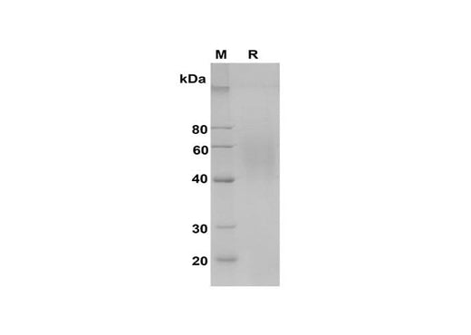 SDS-PAGE analysis of Rat CD163 proteins, 2 μg/lane of Recombinant Rat CD163 proteins was resolved with SDS-PAGE under reducing conditions, showing bands at 40-60 kDa.