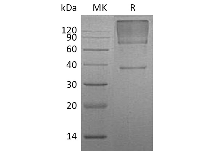 Recombinant Human Glypican 3/GPC3 Protein (His Tag) - ABMIUM