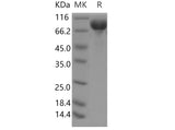 > 95 % as determined by reducing SDS-PAGE.