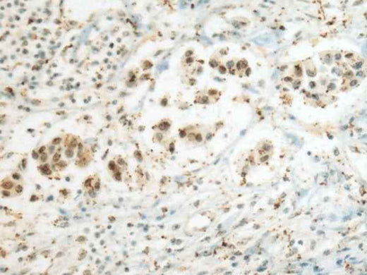 Anti-Human/Mouse SEPHS1 Antibody