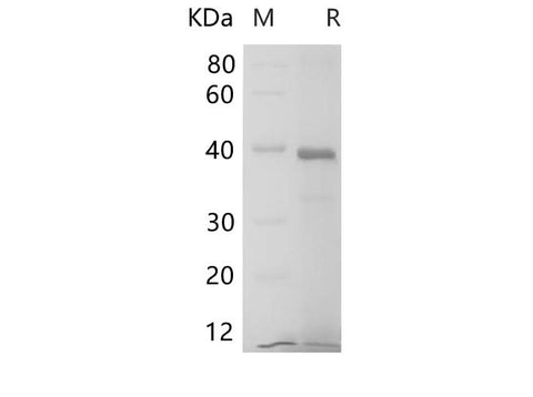 SDS-PAGE analysis of Human IL6R proteins, 2 μg/lane of Recombinant Human IL6R proteins was resolved with SDS-PAGE under reducing conditions, showing bands at 38-40 kDa.