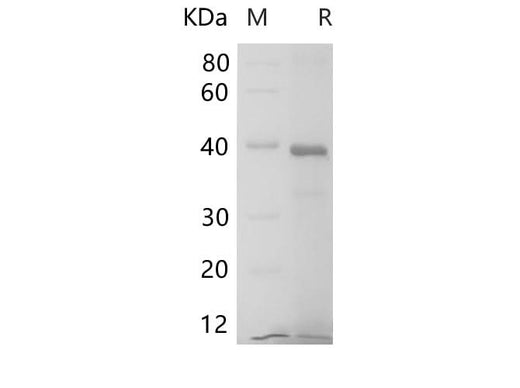 SDS-PAGE analysis of Human IL6R proteins, 2 μg/lane of Recombinant Human IL6R proteins was resolved with SDS-PAGE under reducing conditions, showing bands at 38-40 kDa.