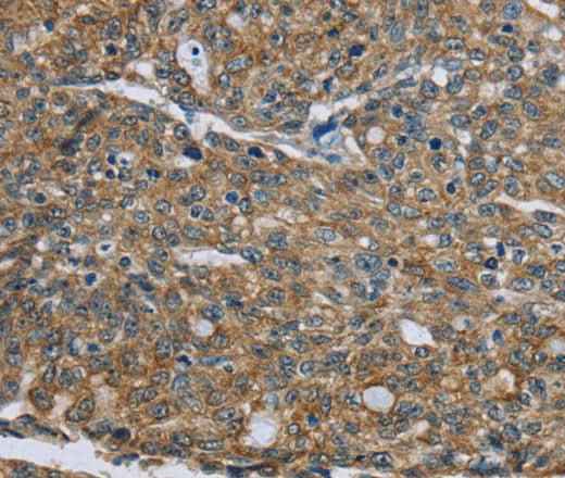 Anti-Human/Mouse/Rat CK-5 Antibody